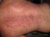 post-3165-1224315276_thumb.jpg